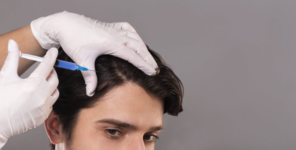 טיפול PRP: הדבר הגדול הבא בתחום השתלות שיער